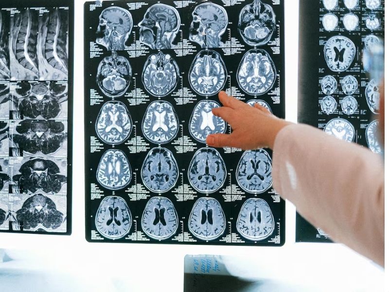 Dos muertos en epidemia de meningitis ‘sin precedentes’ en Inglaterra