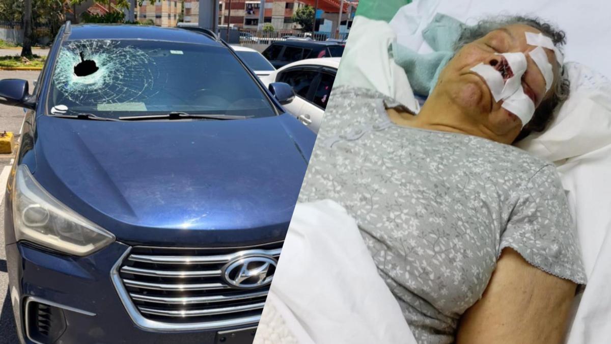 Lanzan piedra desde puente en San Isidro: anciana recibe 30 puntos