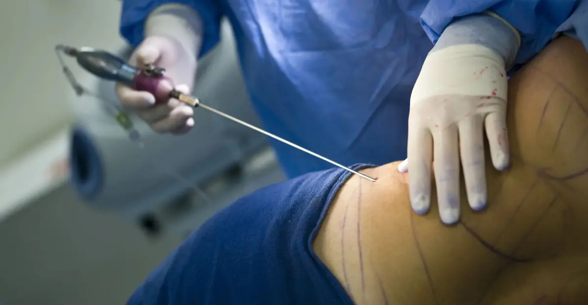 Cómo verificar si un cirujano plástico está certificado en RD