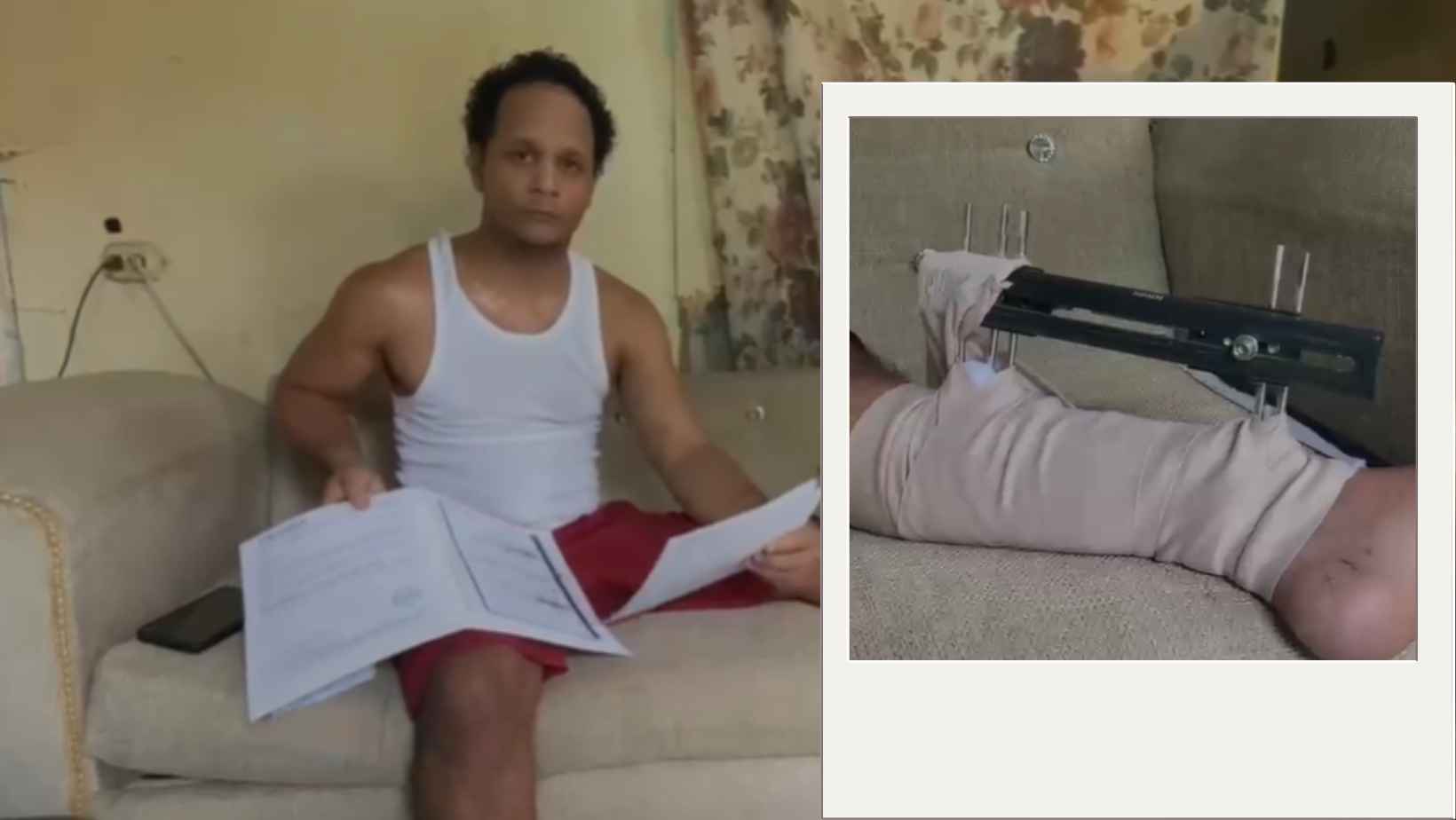 Joven de Hato Mayor pide ayuda para cirugía tras accidente