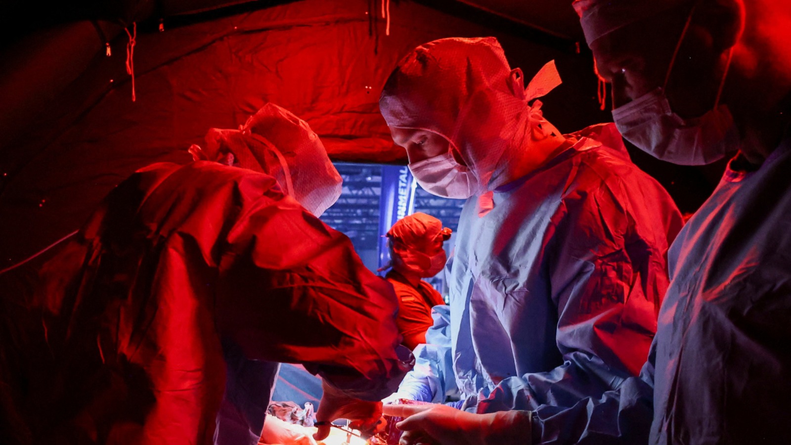 Hito médico: extirpación de tumor cerebral con IA